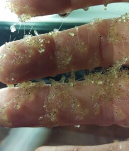 Photo of Center for Limnology graduate student Vince Butitta’s hand covered in invasive spiny water fleas from Lake Mendota (Vince Butitta) PHOTO COURTESY OF VINCE BUTITTA