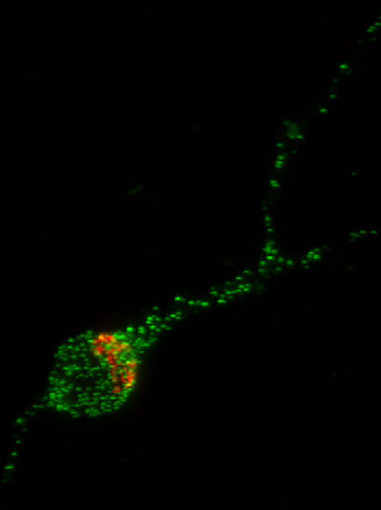 Image of a human stem cell-derived neuron, the Trk-fused gene protein (TFG) is shown in green and the Golgi Apparatus, the organelle which helps package proteins for transport to the rest of the neuron, is shown in red. UW–MADISON