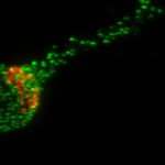 Image of a human stem cell-derived neuron, the Trk-fused gene protein (TFG) is shown in green and the Golgi Apparatus, the organelle which helps package proteins for transport to the rest of the neuron, is shown in red. UW–MADISON