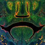 Photo of image of a section through the midface of a mouse embryo illustrating fusion of the tissues that form the secondary palate above the tongue. Green staining illustrates cells expressing a key enzyme that mediates DNA methylation, blue indicates nuclei of all cells, red indicates epithelial cells.