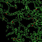 Photo of image, which is a 3D reconstruction showing sites (in red) where the Coat Protein Complex II (COPII) facilitates the packaging of various proteins within a mammalian cell. The green areas are the endoplasmic reticulum, where protein sorting and trafficking takes place. Image courtesy of Anjon Audhya