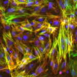 Photo: UW–Madison researchers studied smooth muscle cells like these, derived from induced pluripotent stem cells, to show that long-mysterious variations in an area of our genome harden blood vessels, puting some people at higher risk for cardiovascular disease. Image courtesy Lo Sardo Lab/UW–Madison