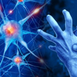 Image: Parkinson’s Disease as a progressive neurological disorder affecting body movement and coordination as neuron cells losing function in the substantia nigra section of the human brain as a degenerative illness. ILLUSTRATION: iSTOCK/ WILDPIXEL