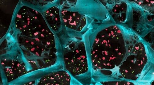 Biodegradable gel boosts immune system’s attack on several cancers in mice