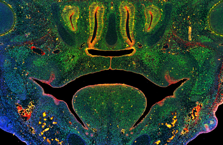 Photo of image of a section through the midface of a mouse embryo illustrating fusion of the tissues that form the secondary palate above the tongue. Green staining illustrates cells expressing a key enzyme that mediates DNA methylation, blue indicates nuclei of all cells, red indicates epithelial cells.
