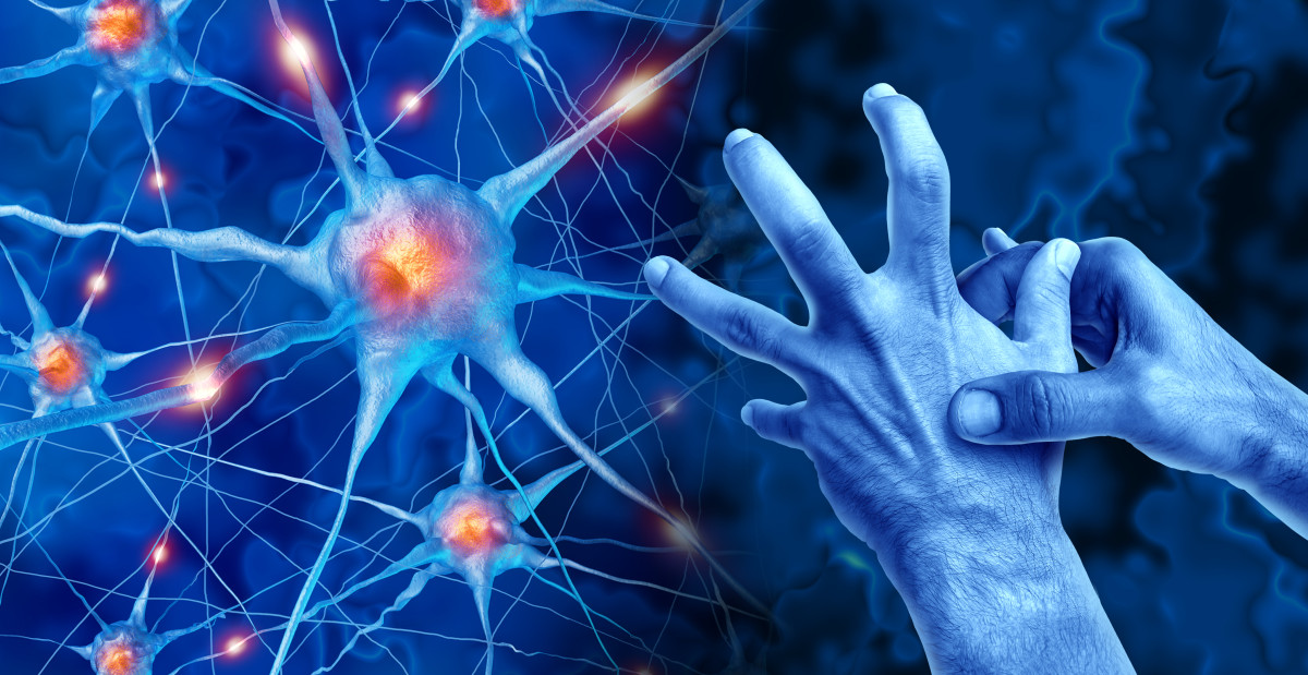 Parkinson’s treatment tested at UW-Madison showing promise in first clinical trial