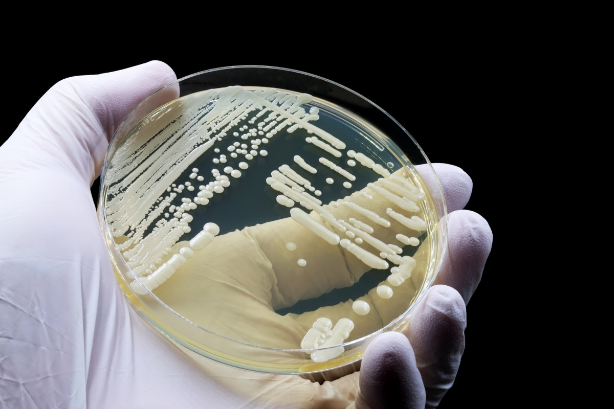 Photo: Candida auris is the first fungus to spread in hospitals and is resistant to all three major classes of antifungal drugs. New research has discovered that the elimination of a single gene stops the fungus from growing — which could lead to an effective drug treatment. Photo: iStock/TopMicrobialStock