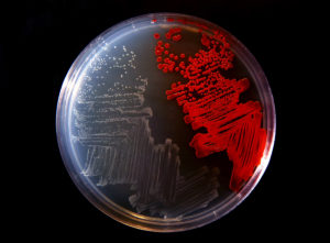 A culture plate is photographed in a biology lab for Professor James Burritt Tuesday, February 16, 2016. The culture plate contains two types of Serratia (bacteria of the Enterobacteriaceae family) -- one from the bees (colorless) and another type used in the teaching lab. (UW-Stout photo by Brett T. Roseman)